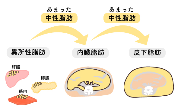 脂肪肝などの異所性脂肪　内臓脂肪　皮下脂肪の順に蓄えられていきます