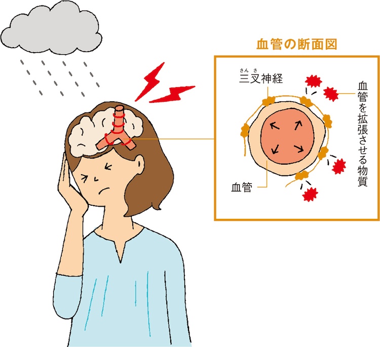 血管の断面図 血管を拡張させる物質 三叉神経 血管