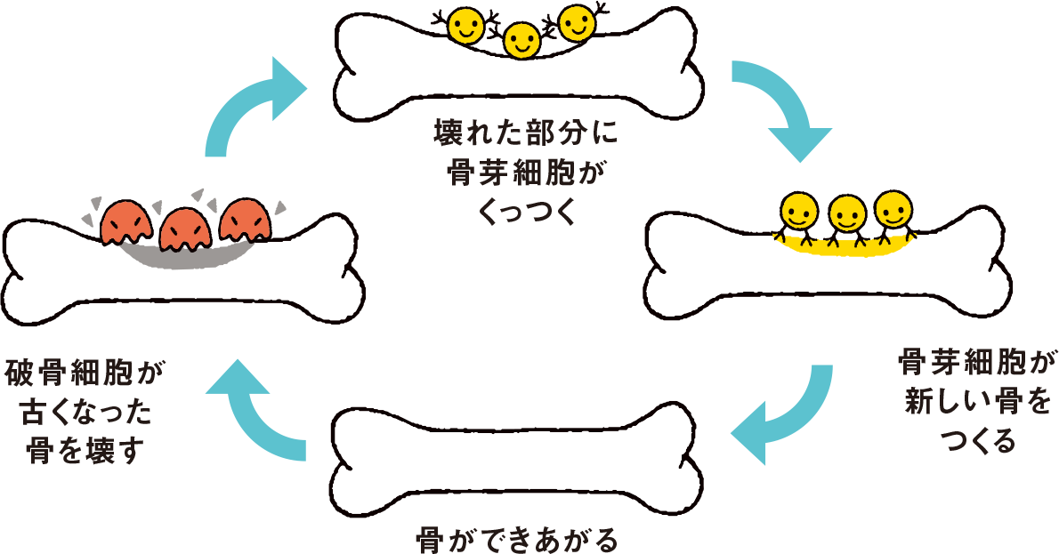 壊れた部分に骨芽細胞がくっつく　骨芽細胞が新しい骨をつくる　骨ができあがる　破骨細胞が古くなった骨を壊す